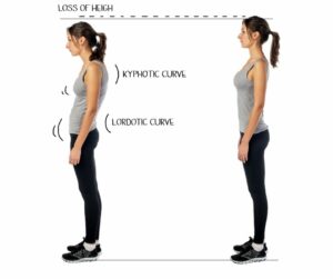 Posture comparison